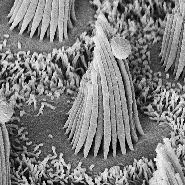 Figure 1: The hair bundle...